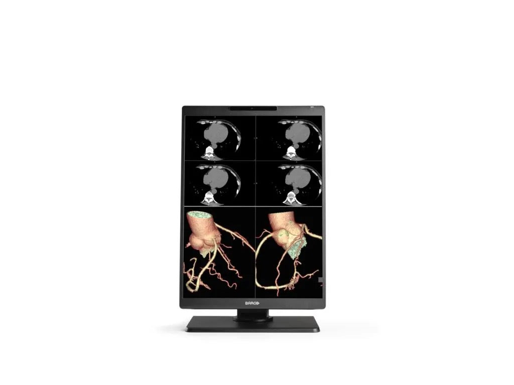 MONITOR GRADO MEDICO BARCO NIO C 3MP 21” EIZO RX270-BK 2MP P/ TOMOGRAFO MAMOGRAFO